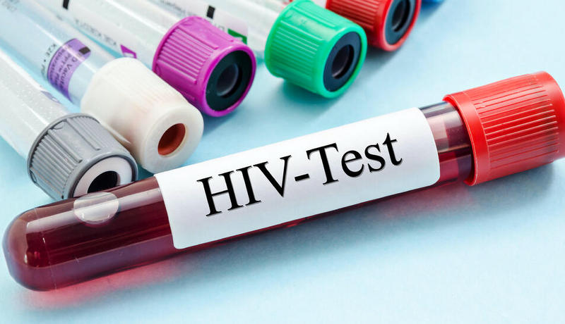 Svjetski dan borbe protiv AIDS-a